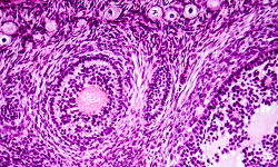 Haematoxylin and eosin (H&E) stain